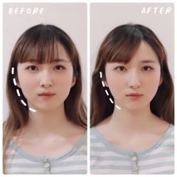 -FACE·日本小颜矫正美容整骨サロン