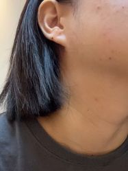 点击看大图 体验后-广州美莱医疗美容医院