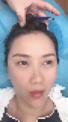 -郡艺医疗美容·微整·眼鼻吸脂