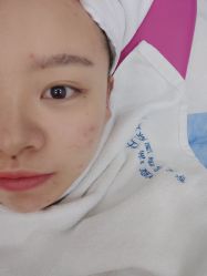 -痘瑞仕·专业祛痘国际连锁