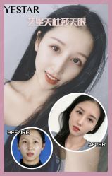 -Yestar艺星医疗美容医院