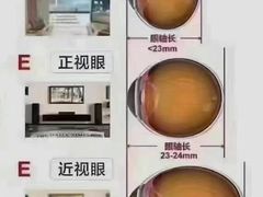 -宝视达眼镜(周口市广场店)