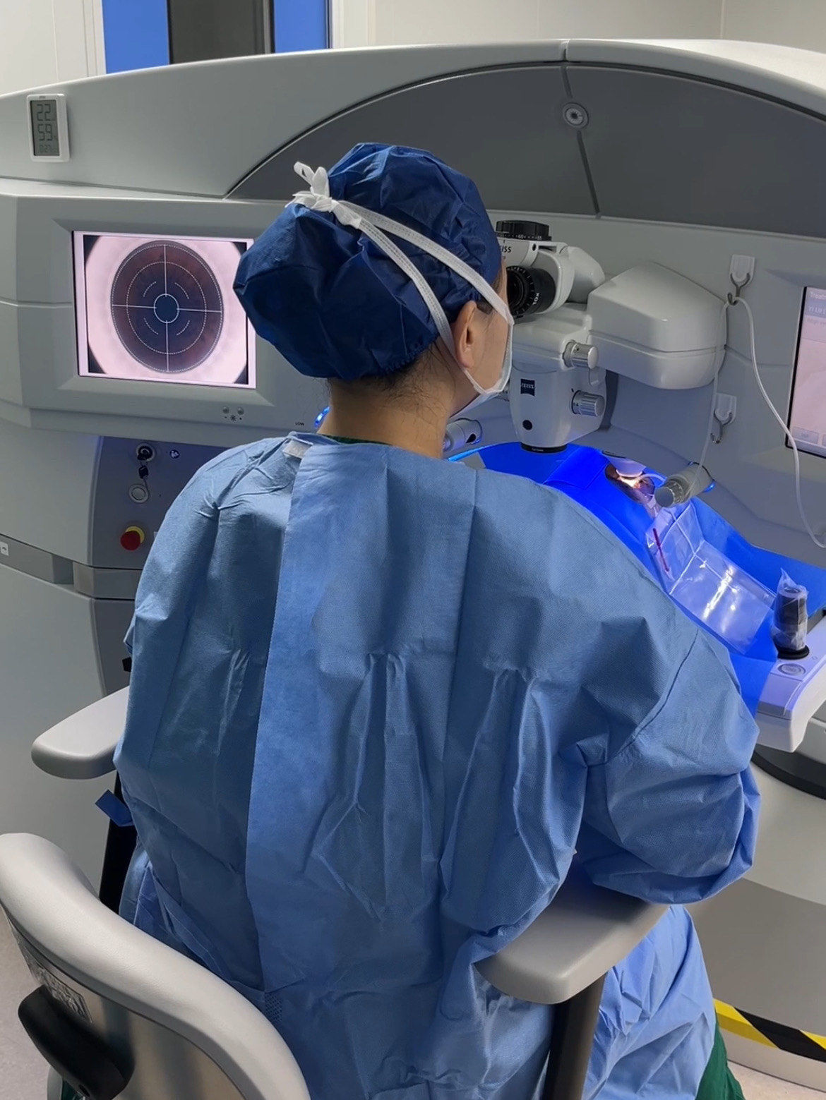 全飞秒近视手术,上班族女孩的摘镜分享