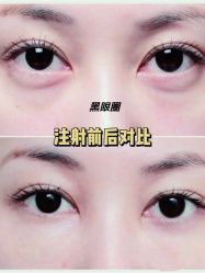 -上海漾颜医疗美容