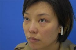 -天津健丽·去眼袋医疗美容机构