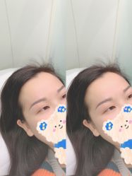 -久匠半永久纹眉