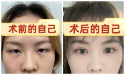 -素美医疗美容·西南眼鼻整形·修复基地