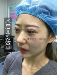 -广州健丽·去眼袋医疗美容机构
