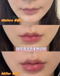 -南京美莱医疗美容·旗舰店