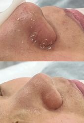 -SKIN79皮肤管理中心