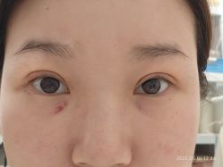 -杭州美莱医疗美容医院