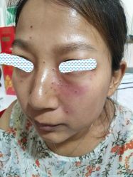 -北京美痣堂古方祛痣斑疣瘊