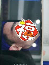 点击看大图 -蕾特恩专业祛痘·皮肤管理