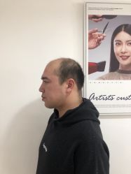 -极客侠男士假发定制补发