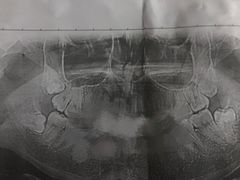 -天津市第三中心医院