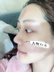 -素美医疗美容·西南眼鼻整形·修复基地