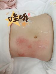 -Lily纤美·科技减脂中心