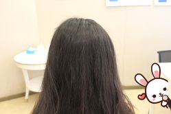 -大麦微针植发丨全国连锁