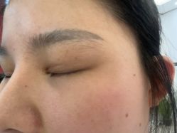 -长沙雅美医疗美容医院
