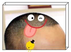 -大麦微针植发全国连锁