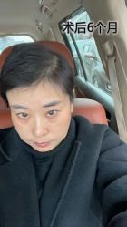 -雍禾植发全国连锁