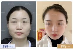 -圣嘉新医疗美容医院