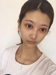 -广东韩妃整形外科医院