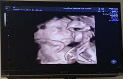 -杭州贝瑞斯美华妇儿医院·早孕·产检·儿科