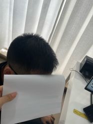 -大麦微针植发丨全国连锁