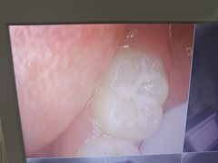 -土豆口腔(凤凰北总店)