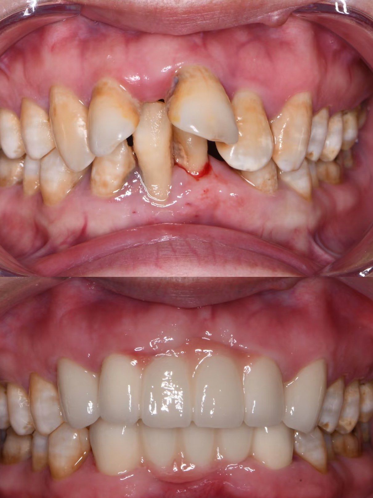 修复前后对比,就是这么神奇!
这位顾