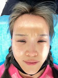 体验前-海涛医疗美容·面部抗衰·注射美鼻