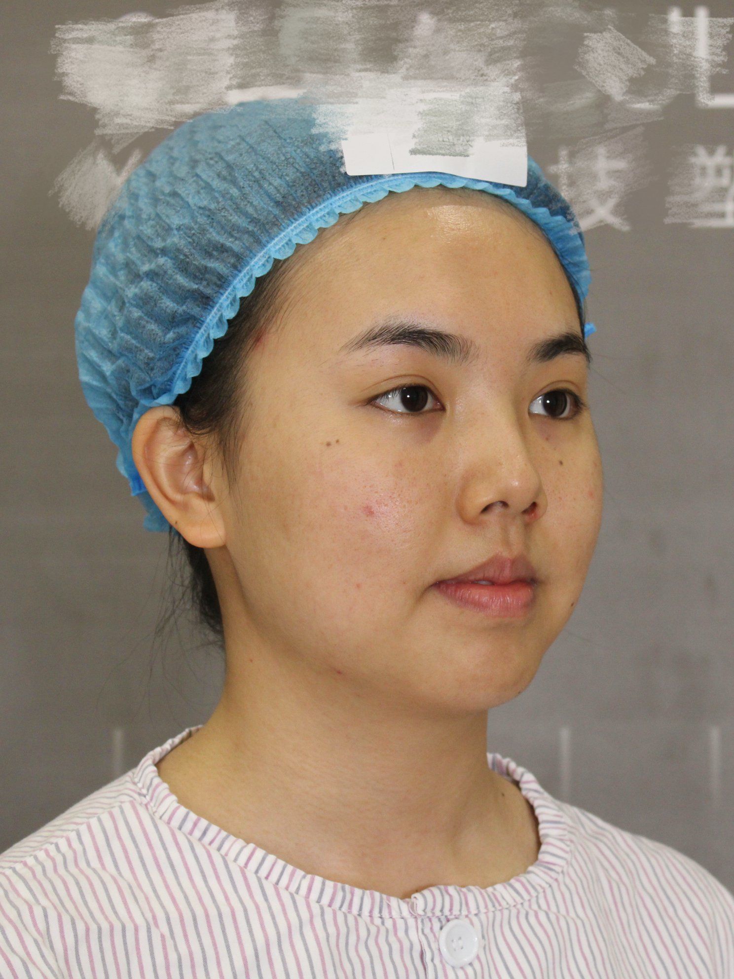 体验30天后效果分享