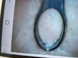 -凡碧诗毛孔清洁收细