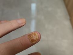 -世龙世家甲沟炎·灰指甲·嵌甲矫正·修脚(武侯区双楠店)