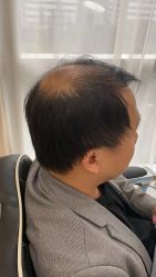 -发饰美男士增发补发假发定制店