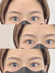 点击看大图 -杨益美学·野生眉半永久纹眉发际线