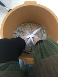 -派恩宜灰指甲鸡眼嵌甲手足癣