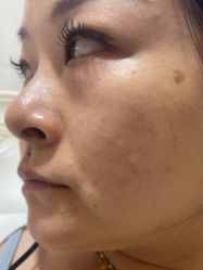 -安徽合肥韩美整形外科医院