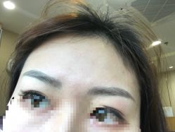 体验后-深圳美莱医疗美容医院