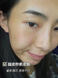 -Yestar宁波艺星整形医院