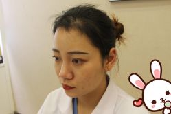 -大麦微针植发丨全国连锁