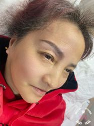 体验后-比华利美容医院