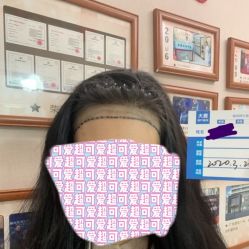 -大麦微针植发全国连锁