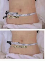 -Lily纤美·科技减脂中心
