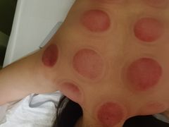 -久健盲人推拿(春江佳园店)