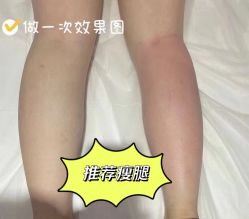 -Lily纤美·科技减脂中心