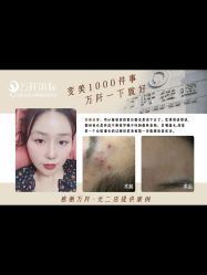 -万阡国际专业祛斑·祛痣·祛疤连锁