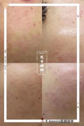 -E.beauty驻颜·痘敏肌调理中心