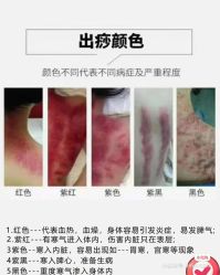 点击看大图 -玛莲朵·海菲秀冰珀科